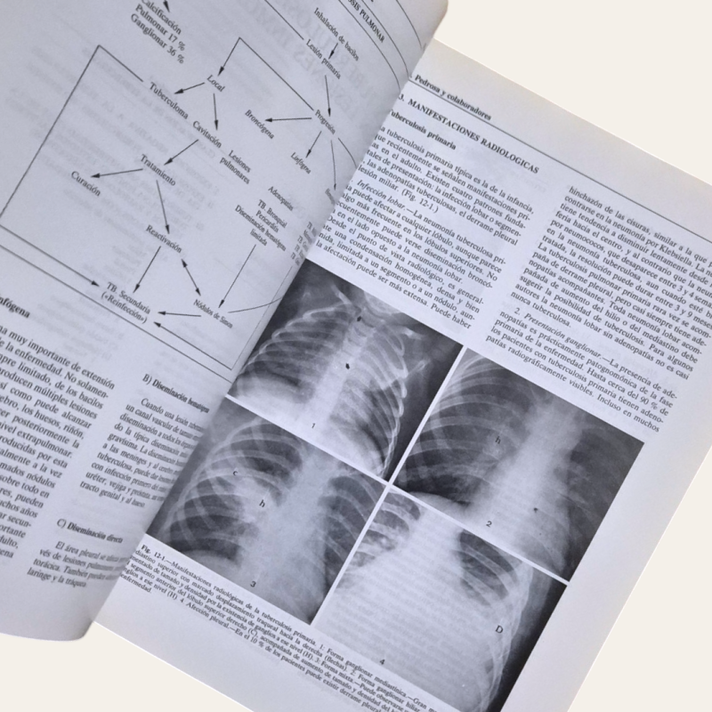 Diagnóstico por imagen. Compendio de radiología clínica